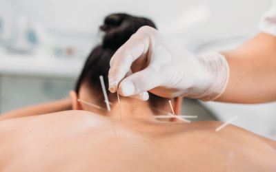 The Benefits of Combining Chiropractic Care and Acupuncture in Your Wellness Routine