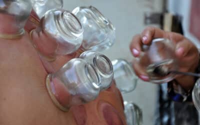 Unlock the Healing Potential of Cupping Therapy at The Source Wellness Center