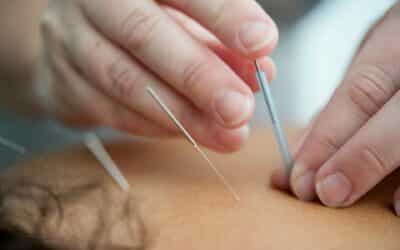 How Acupuncture Targets Anxiety Symptoms